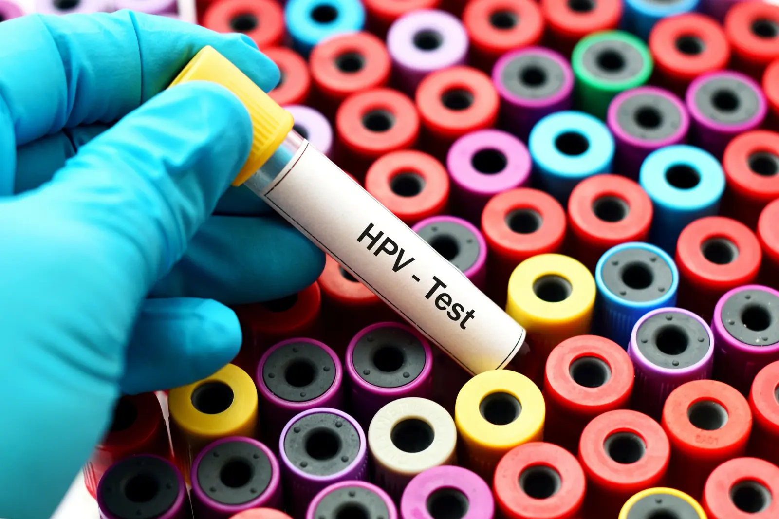 Rodzaje testów na HPV