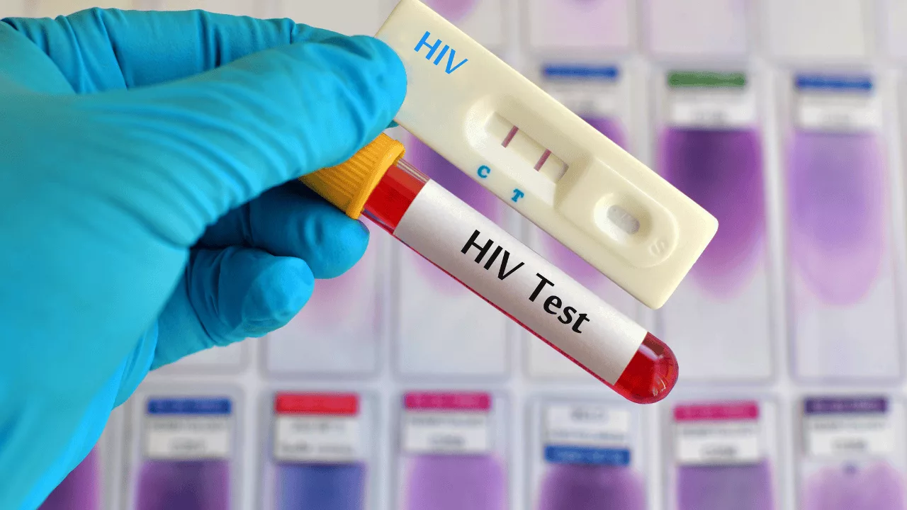 Badanie na ludzki wirus niedoboru odporności (HIV) Warszawa (Wola/Śródmieście)